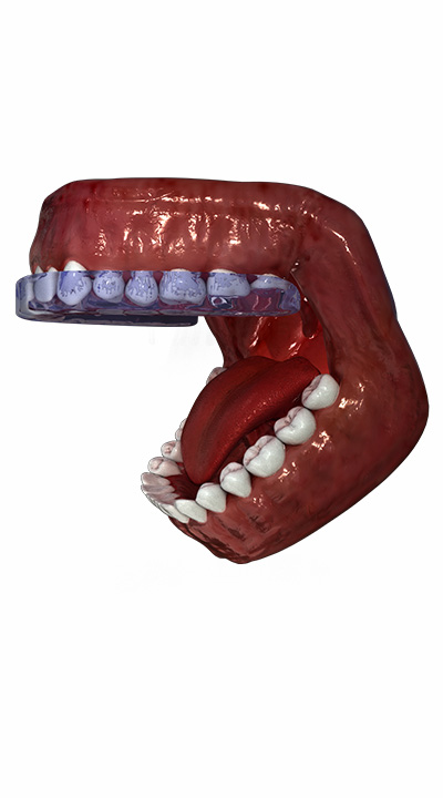 Medical